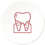 Plaque build-up