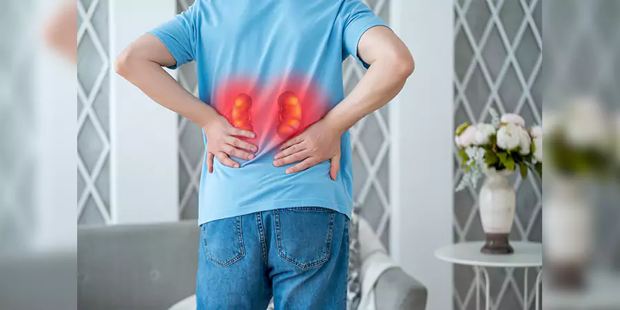 Kidney Stone Pain: Where Can It Be Felt